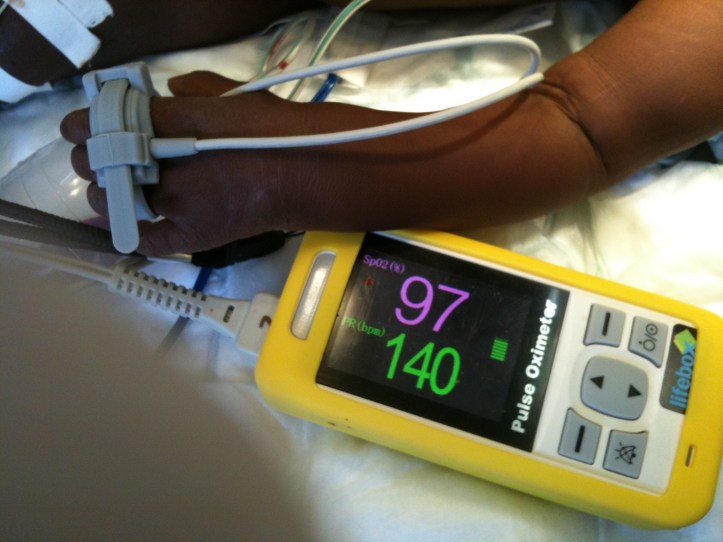 Pulse Oximeter in neonatal unit at a hospital in Malawi. (Image courtesy www.safesurgery.wordpress.com)