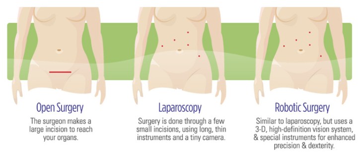 surgery-comparison
